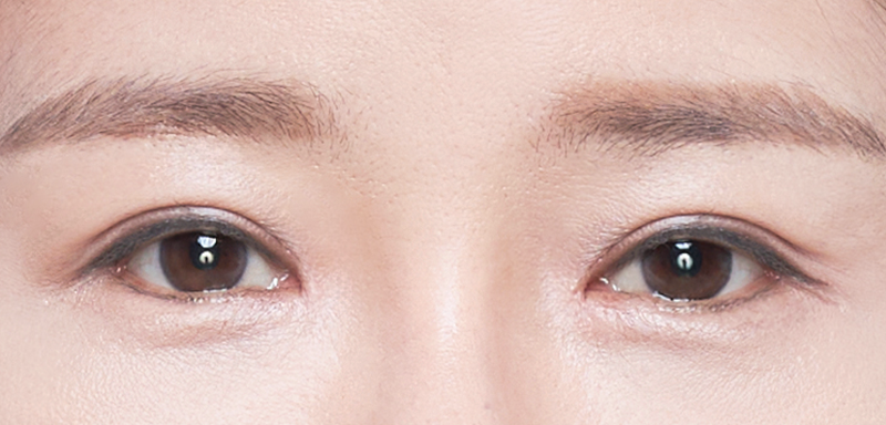 Garis mata yang cantik dan koreksi otot mata